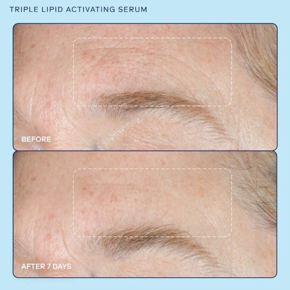 🆕 SKINFIX Barrier+ Triple Lipid Collagen Activating Serum 30 mL Authentic & NIB - Picture 7 of 8